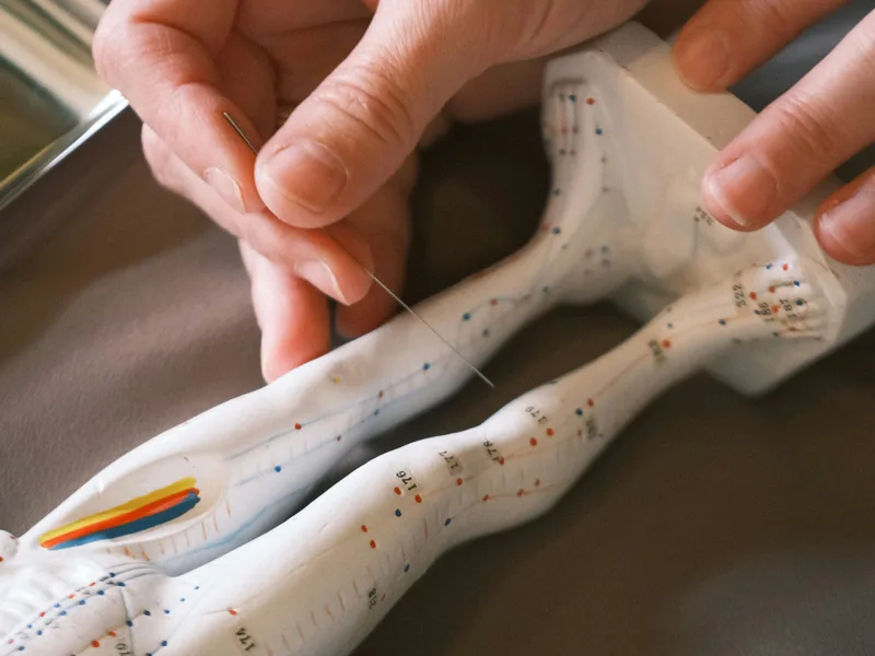 Acupuncture at Sovereign Light Chiropractic in Suwanee