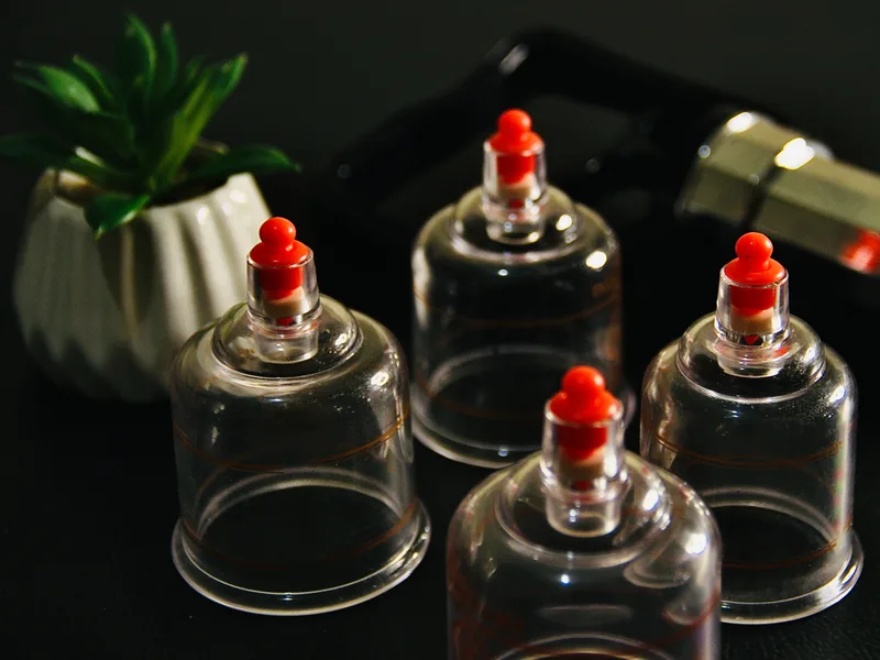 How Cupping Therapy works at Sovereign Light Chiropractic