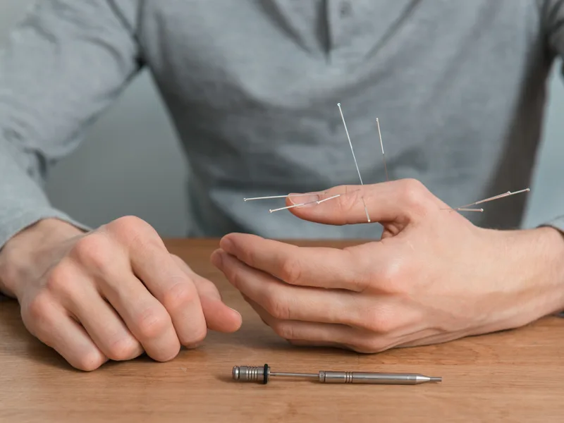 Dry Needling at Sovereign Light Chiropractic in Suwanee